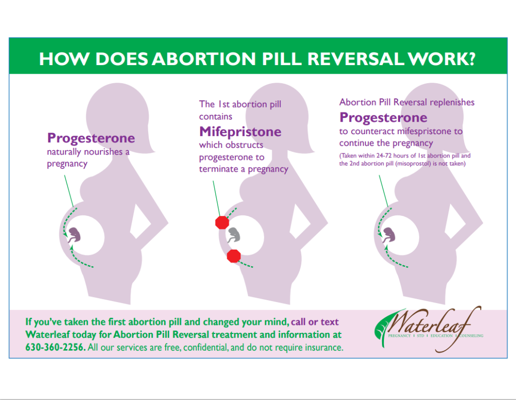 abortion-pills-are-safe-and-could-ease-growing-access-crisis-for-women