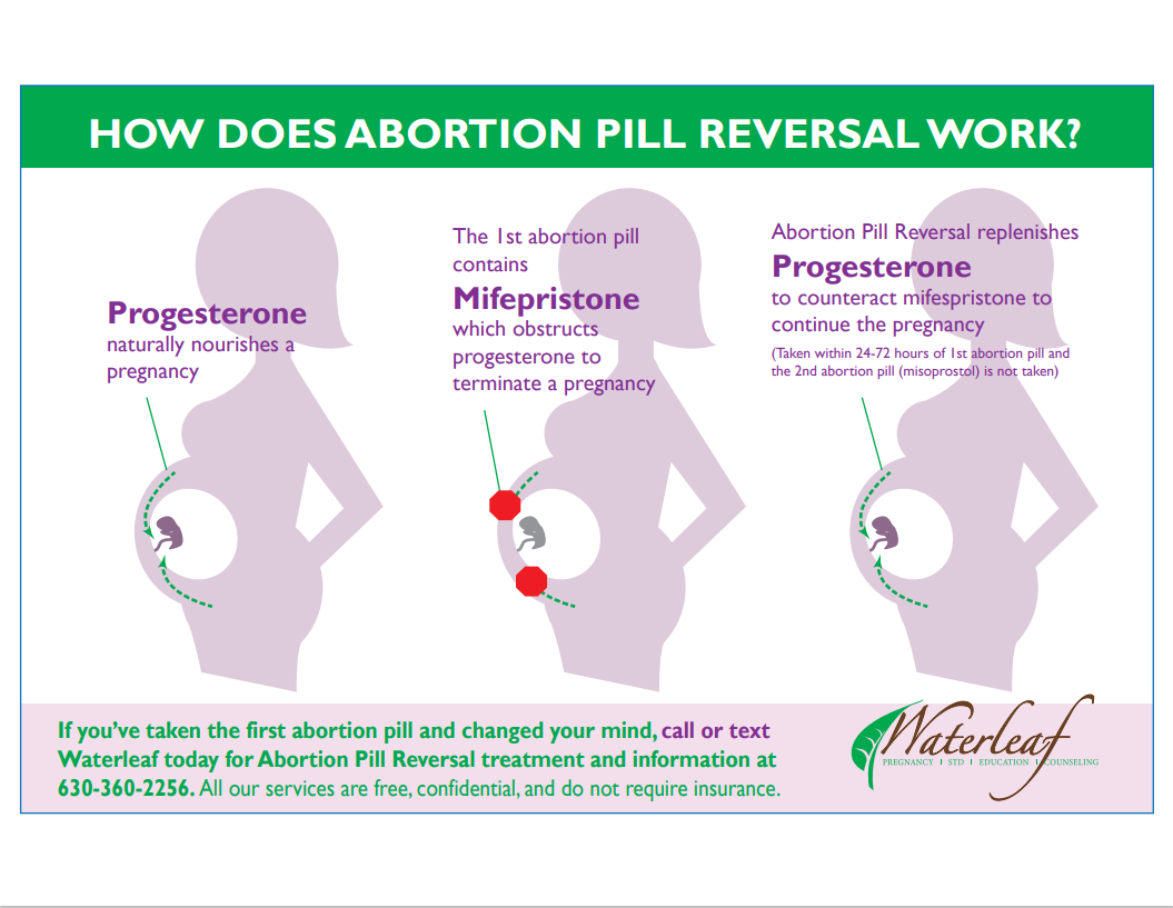 Can the abortion pill be reversed?